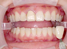 �G���v���X ���ÑO