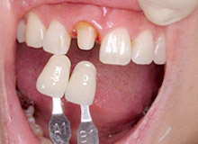 �G���v���X ���Ò�