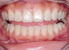 �G���v���X���Ì�