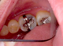 �n�C�u���b�g�Z���~�b�N �y�r�t�H�A�[�z 