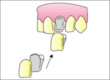 ���^���Z���~�b�N���ÃC���[�W