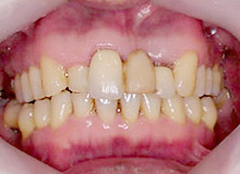 ���^���Z���~�b�N�i���^���{���h�j �y�r�t�H�A�[�z