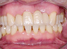 ���^���Z���~�b�N�i���^���{���h�j �y�A�t�^�[�z