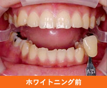 �z���C�g�j���O�O