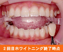 �Q��ڃz���C�g�j���O�I�����_