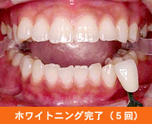 �z���C�g�j���O�����i5��j