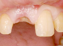 �C���v�����g ���ÑO