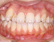 �������ÑO