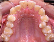 �������ÑO