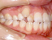 �������ÑO