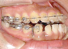 �������Ì�i�����^�j