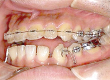 �������Ì�i�����^�j