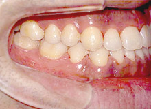 �������Ì�i�����^�j