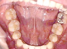 �������Ì�i�����^�j